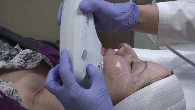 Ultherapy by Dr. Sheena featured in abc7 news