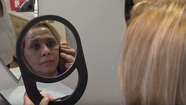 Client looking at her face in mirror